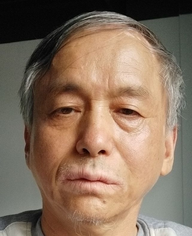 9杰米的第一张照片--四川残疾人相亲网